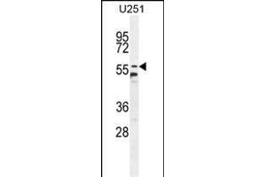 CCDC9 Antibody (N-term) (ABIN654741 and ABIN2844427) western blot analysis in  cell line lysates (35 μg/lane). (CCDC9 Antikörper  (N-Term))