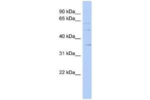 Western Blotting (WB) image for anti-Solute Carrier Family 22 (Organic Cation Transporter), Member 17 (SLC22A17) (Middle Region) antibody (ABIN2781648)