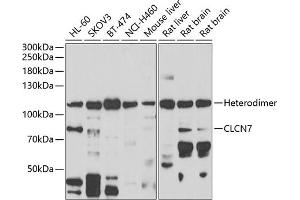 Western blot analysis of extracts of various cell lines, using CLCN7 antibody (ABIN6133268, ABIN6138670, ABIN6138672 and ABIN6222613) at 1:1000 dilution. (CLCN7 Antikörper  (AA 626-805))