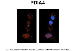Sample Type: NT2 cells Red: Antibody Blue: DAPI Primary Dilution: 1ug/50ul antibody Secondary Antibody: Alexa goat anti-rabbit 594 Image Submitted by: Yuzhi Chen, University of Arkansas for Medical Sciences (PDIA4 Antikörper  (N-Term))