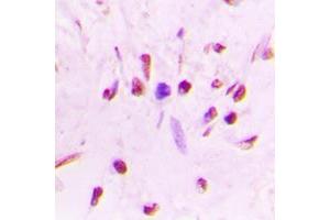 Immunohistochemistry (IHC) image for anti-Heat Shock Factor Protein 1 (HSF1) (pSer303) antibody (ABIN7300840)