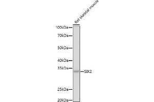 SIX2 Antikörper  (C-Term)