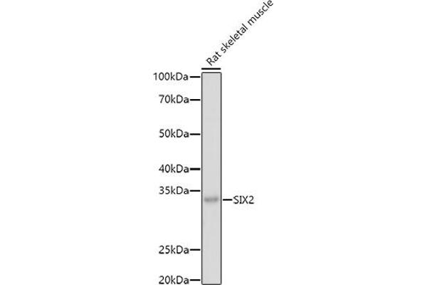 SIX2 Antikörper  (C-Term)