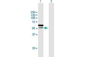 Western Blot analysis of C1orf124 expression in transfected 293T cell line by C1orf124 MaxPab polyclonal antibody. (Spartan Antikörper  (AA 1-489))