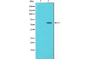 CHEK1 Antikörper  (pSer280)