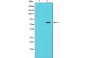 Western blot analysis of Chk1 phosphorylation expression in UV treated HT29 whole cell lysates,The lane on the left is treated with the antigen-specific peptide. (CHEK1 Antikörper  (pSer280))
