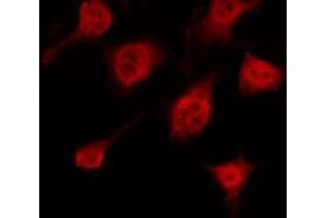 ABIN6266577 staining HeLa by IF/ICC. (Keratin 10 Antikörper  (Internal Region))