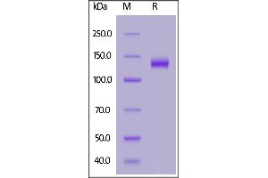 Human Netrin receptor DCC, His Tag on  under reducing (R) condition. (DCC Protein (AA 32-1097) (His tag))