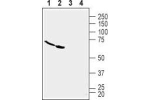 Western blot analysis of human U-87 MG glioblastoma cell line lysate (lanes 1 and 3) and human Malme-3M melanoma cell line lysate (lanes 2 and 4): - 1,2. (TNFRSF19 Antikörper  (Extracellular, N-Term))