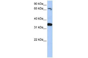 WB Suggested Anti-GLE1 Antibody Titration: 0. (GLE1 Antikörper  (N-Term))