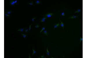 Immunofluorescence staining of Hela cells with ABIN7147892 at 1:100, counter-stained with DAPI. (Claudin 18 Antikörper  (AA 196-261))