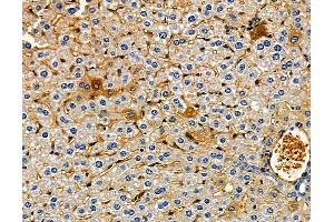 ABIN7094920 and ABIN7098976 at 1/100 staining mouse liver tissue by IHC-P.