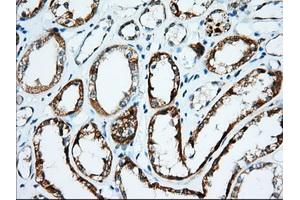 Immunohistochemical staining of paraffin-embedded Human Kidney tissue using anti-IGF2BP2 mouse monoclonal antibody.