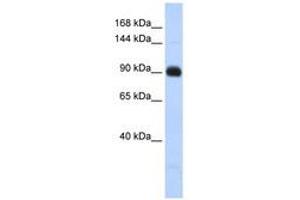 Image no. 1 for anti-Matrilin 2 (MATN2) (AA 791-840) antibody (ABIN6741404) (MATN2 Antikörper  (AA 791-840))