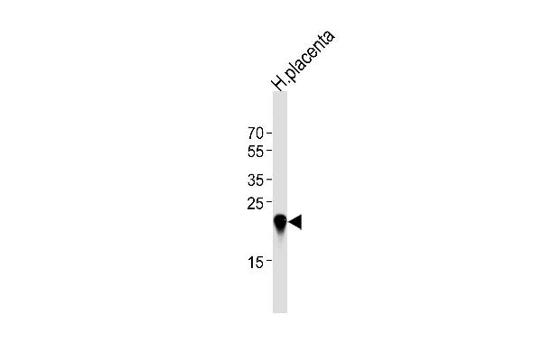 CSHL1 Antikörper  (C-Term)