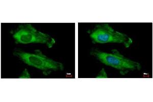 ICC/IF Image RPS10 antibody detects RPS10 protein at cytoplasm by immunofluorescent analysis. (RPS10 Antikörper)