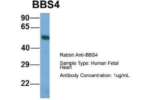 Host: Rabbit  Target Name: BBS4  Sample Tissue: Human Fetal Heart  Antibody Dilution: 1. (BBS4 Antikörper  (N-Term))