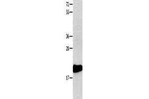 Gel: 10+12 % SDS-PAGE, Lysate: 40 μg, Lane: 231 cells, Primary antibody: ABIN7190308(CMTM3 Antibody) at dilution 1/350, Secondary antibody: Goat anti rabbit IgG at 1/8000 dilution, Exposure time: 1 minute (CMTM3 Antikörper)