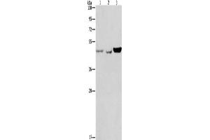 Gel: 8 % SDS-PAGE, Lysate: 40 μg, Lane 1-3: A431 cells, A549 cells, hela cells, Primary antibody: ABIN7189629(ACP2 Antibody) at dilution 1/150, Secondary antibody: Goat anti rabbit IgG at 1/8000 dilution, Exposure time: 40 seconds (ACP2 Antikörper)
