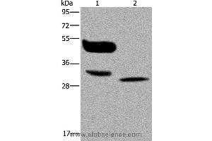Western blot analysis of A375 cell and human lung cancer tissue, using MAGEA8 Polyclonal Antibody at dilution of 1:400 (MAGEA8 Antikörper)