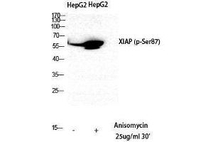 Western Blotting (WB) image for anti-X-Linked Inhibitor of Apoptosis (XIAP) (pSer87) antibody (ABIN3182566) (XIAP Antikörper  (pSer87))