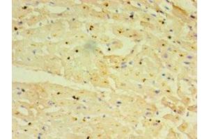 Immunohistochemistry of paraffin-embedded human heart tissue using ABIN7151238 at dilution of 1:100 (TRIM11 Antikörper  (AA 267-468))