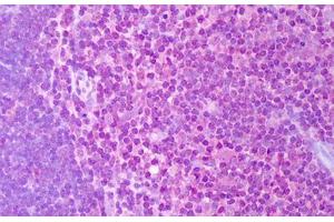 Anti-IL-2 antibody IHC staining of human thymus.