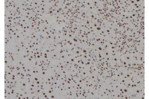 ABIN6279494 at 1/100 staining Mouse liver tissue by IHC-P. (HOXC13 Antikörper  (C-Term))