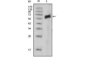 Western Blot showing AXL antibody used against extracellular domain of human AXL (aa19-444).
