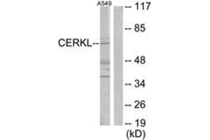 Western blot analysis of extracts from A549 cells, using CERKL Antibody. (CERKL Antikörper  (AA 341-390))