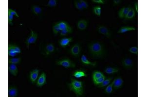 Immunofluorescent analysis of MCF-7 cells using ABIN7171879 at dilution of 1:100 and Alexa Fluor 488-congugated AffiniPure Goat Anti-Rabbit IgG(H+L) (Tetraspanin 5 Antikörper  (AA 114-232))