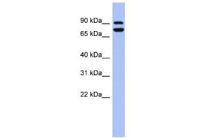 WB Suggested Anti-SOX6 Antibody Titration:  0. (SOX6 Antikörper  (Middle Region))