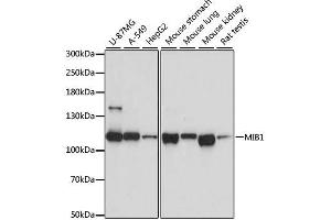 Western blot analysis of extracts of various cell lines, using MIB1 antibody. (MIB1 Antikörper  (AA 560-860))