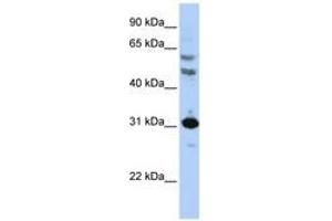 Image no. 1 for anti-Homeobox B5 (HOXB5) (AA 36-85) antibody (ABIN6741415) (HOXB5 Antikörper  (AA 36-85))