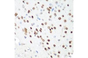 Immunohistochemistry of paraffin-embedded rat brain using CDK1 antibody. (CDK1 Antikörper  (AA 1-297))