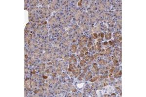 Immunohistochemical staining (Formalin-fixed paraffin-embedded sections) of human pancreas with LRFN5 polyclonal antibody  shows strong cytoplasmic positivity in glandular cells at 1:20-1:50 dilution.