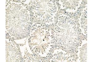 ABIN7094493 and ABIN7098542 at 1/100 staining Rat testis tissue by IHC-P. (CHD4 Antikörper  (Internal Region))
