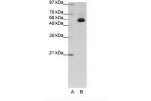 Image no. 1 for anti-Zinc Finger Protein 307 (ZKSCAN4) (C-Term) antibody (ABIN202741) (ZKSCAN4 Antikörper  (C-Term))