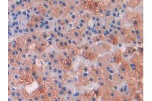 Immunohistochemistry (IHC) image for anti-Interleukin 1 Receptor, Type I (IL1R1) (AA 119-217) antibody (ABIN7430741)