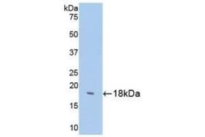 Detection of Recombinant SST, Human using Polyclonal Antibody to Somatostatin (SST) (Somatostatin Antikörper  (AA 1-116))