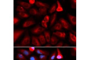 Immunofluorescence analysis of U2OS cells using FKBP4 Polyclonal Antibody (FKBP4 Antikörper)