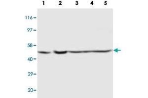 Western blot analysis of tissue and whole cell extracts with PSEN2 polyclonal antibody . (Presenilin 2 Antikörper  (Internal Region))
