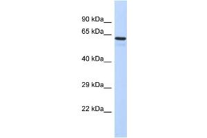 Host:  Rabbit  Target Name:  TBX3  Sample Type:  Fetal Liver lysates  Antibody Dilution:  1. (TBX3 Antikörper  (C-Term))