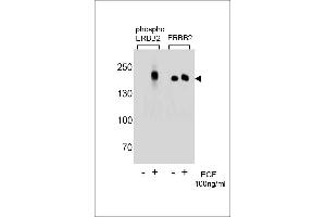 Western blot analysis of extracts from A431 cells,untreated or treated with EGF,100 ng/mL,using phospho ERBB2  (left) or ERBB2 Antibody (right)