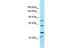 Western Blotting (WB) image for anti-Microcephalin 1 (MCPH1) (C-Term) antibody (ABIN2789648) (MCPH1 Antikörper  (C-Term))