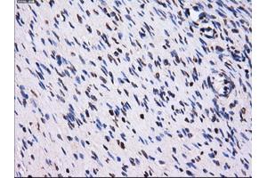 Immunohistochemical staining of paraffin-embedded Ovary tissue using anti-PPME1mouse monoclonal antibody. (PPME1 Antikörper)