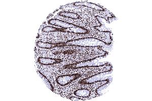 Immunohistochemistry (IHC) image for anti-X-Ray Repair Complementing Defective Repair in Chinese Hamster Cells 5 (Double-Strand-Break Rejoining) (XRCC5) antibody (ABIN7477623)