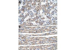 Immunohistochemical staining (Formalin-fixed paraffin-embedded sections) of human liver (A) and human heart (B) with DLX5 polyclonal antibody  at 4-8 ug/mL working concentration. (DLX5 Antikörper  (N-Term))