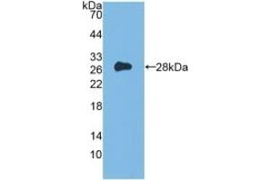 Detection of Recombinant Flt3, Mouse using Polyclonal Antibody to FMS Like Tyrosine Kinase 3 (Flt3) (FLT3 Antikörper  (AA 335-544))