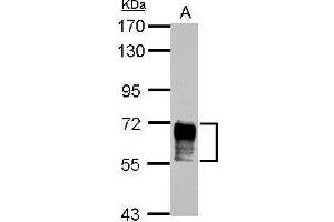 NAB2 anticorps